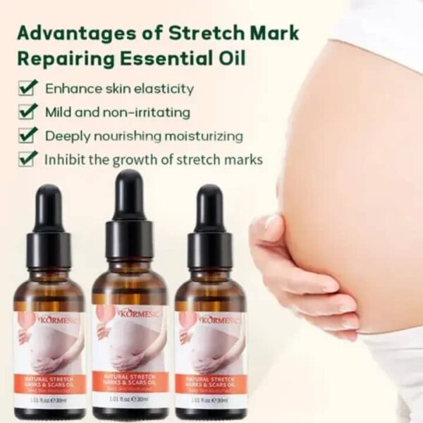 Stretch marks oil